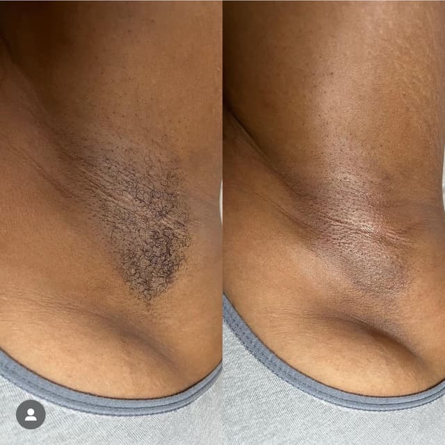 Pro Wax at Bliss Beauty & Aesthetics in Phoenix, AZ