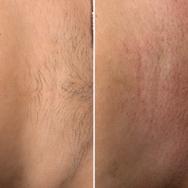 Premium wax at Bliss Beauty & Aesthetics in Phoenix, AZ